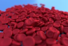 Melawan Anemia dengan Makanan Sehat Anemia